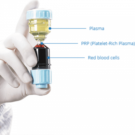 PRP Image 4 PRP Image 4